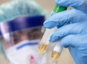 В Чили за сутки коронавирусом заболели почти 900 человек