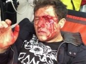 Джеджула обвиняет экс-супругу Санту Димопулос в жестоком избиении 