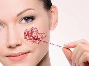 Избавляемся от сосудистых звездочек за 10 дней 