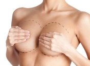 5 масел, которые помогут сохранить упругость груди после беременности