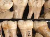 Ученые рассказали, кто придумал стоматологические инструменты