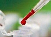 С помощью анализа крови можно узнать, нужны ли антибиотики пациенту