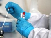 В Україні стрибок нових випадків COVID-19 після вихідних: лідером захворюваності став Київ