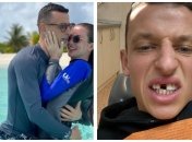 Украинский футболист лишился переднего зуба в матче за день до своей свадьбы (фото)