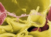 Заражение сальмонеллой - необычная и эффективная форма терапии раковых опухолей