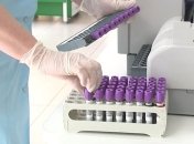 Сразу в девяти областях Украины за сутки подскочило число новых случаев и смертей от коронавируса