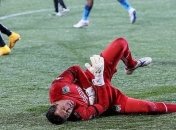 Экс-голкипер сборной Украины сломал руку