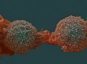 Ученые нашли лекарства, воздействующие на неизлечимую форму рака