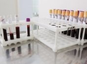 В Украине зафиксирована вспышка менингита