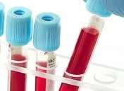 Выздоровела от COVID-19: жительница Черкасс стала первым в Украине донором плазмы крови