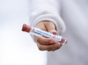 На Буковині за неділю зафіксували 69 нових випадків коронавірусу