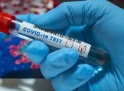 Ужасные кровати и старый ремонт: чиновник показал условия содержания COVID-пациентов в киевской больнице (фото)