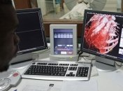 Избыток кальция приводит к смертельным заболеваниям сердца