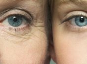 Морщины расскажут вам о заболеваниях