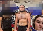 Боец ММА сломал нос жене в Омске