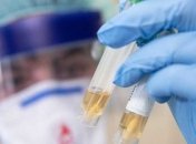 У Венесуелі зафіксовано перші два випадки зараження коронавірусом