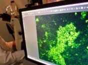 Обнаружен новый вирус, сходный по типу атипичной пневмонией