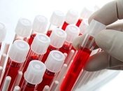 Ученые могут определить вероятность смерти по анализу крови