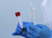 Коронавирус: за сутки в Хмельницкой области выявили еще 10 инфицированных 