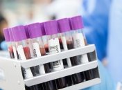 У світі підтверджено 1 604 855 випадків коронавірусу