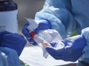 У Запоріжжі 18 осіб перевіряють на коронавірус