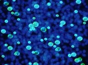 Удивительное сходство: как бактерии могут помочь в изучении мозга (Видео)