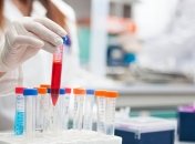 Лекарство от болезни Альцгеймера не прошло клинические испытания 