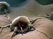 Ученые назвали причины высокой смертности во время лечения рака