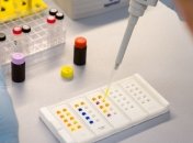 Медики рассказали, могут ли украинские насекомые переносить вирус Зика