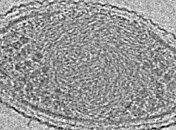 Сделан снимок бактерий, в существование которых не верили