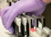 На Запоріжжі зафіксували дев'ять нових випадків коронавірусу