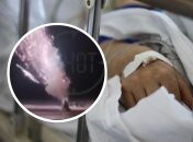 Чоловіка госпіталізували до лікарні з відкритою черепно-мозковою травмою