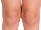 Врачи нашли в колене новую часть тела.