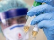 В Україні 56 нових підозр на коронавірус