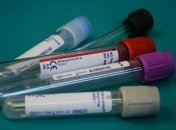 У Нідерландах за добу виявили 1159 нових випадків коронавірусу