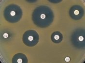 В США была обнаружена уникальнейшая бактерия