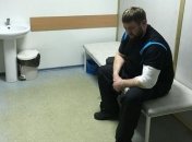 В Днепропетровске избит депутат из партии "Оппозиционный блок"