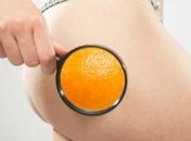 4 простых способа избавиться от целлюлита