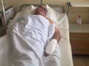 Неизвестные избили главу Раздельнянского райсовета Одесской области