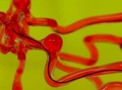 Меньше одного миллиметра: новый робот-змея поможет справится с последствиями инсульта (Видео)