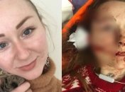 Зверское нападение на украинку в турецком торговом центре: фото девушки до и после происшествия