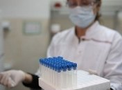 Во Львовской области вспышка COVID-19: за сутки 65 новых случаев