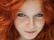 Эти советы помогут вам избавиться от веснушек