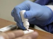 У військового ЗСУ підтвердили коронавірус