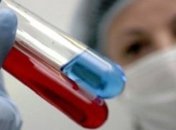 У двох україців, які повернулись з Італії, не виявили коронавірус