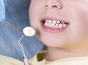 Под Киевом ребенку удалили сразу 12 зубов, мама обвиняет врачей