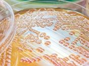 Ученые нашли возможную причину "необъяснимой" головной боли в зданиях