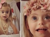 2-летняя девочка с синдромом Дауна стала моделью благодаря своей улыбке (Фото)