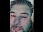 "Ходячая реклама "зеленой власти": в Ивано-Франковске напали на скандального блогера и активиста (видео)