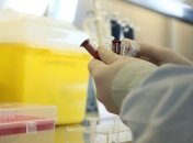 Российскую вакцину против ВИЧ-СПИД испытают на людях  